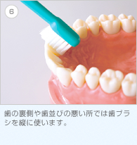 6. 歯の裏側や歯並びの悪い所では歯ブラシを縦に使います。
